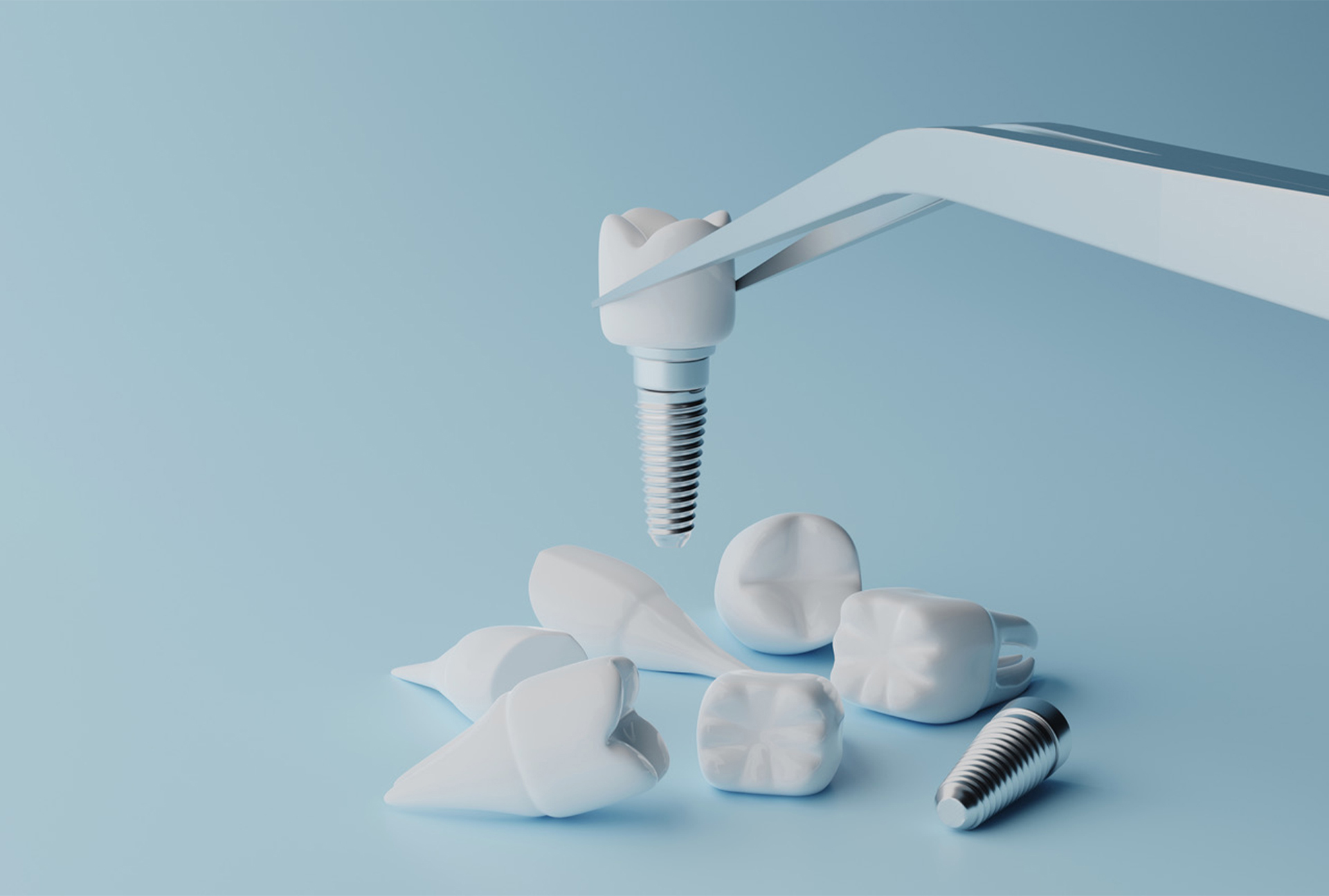 Dental Implants Procedure and Dentist in South Mumbai