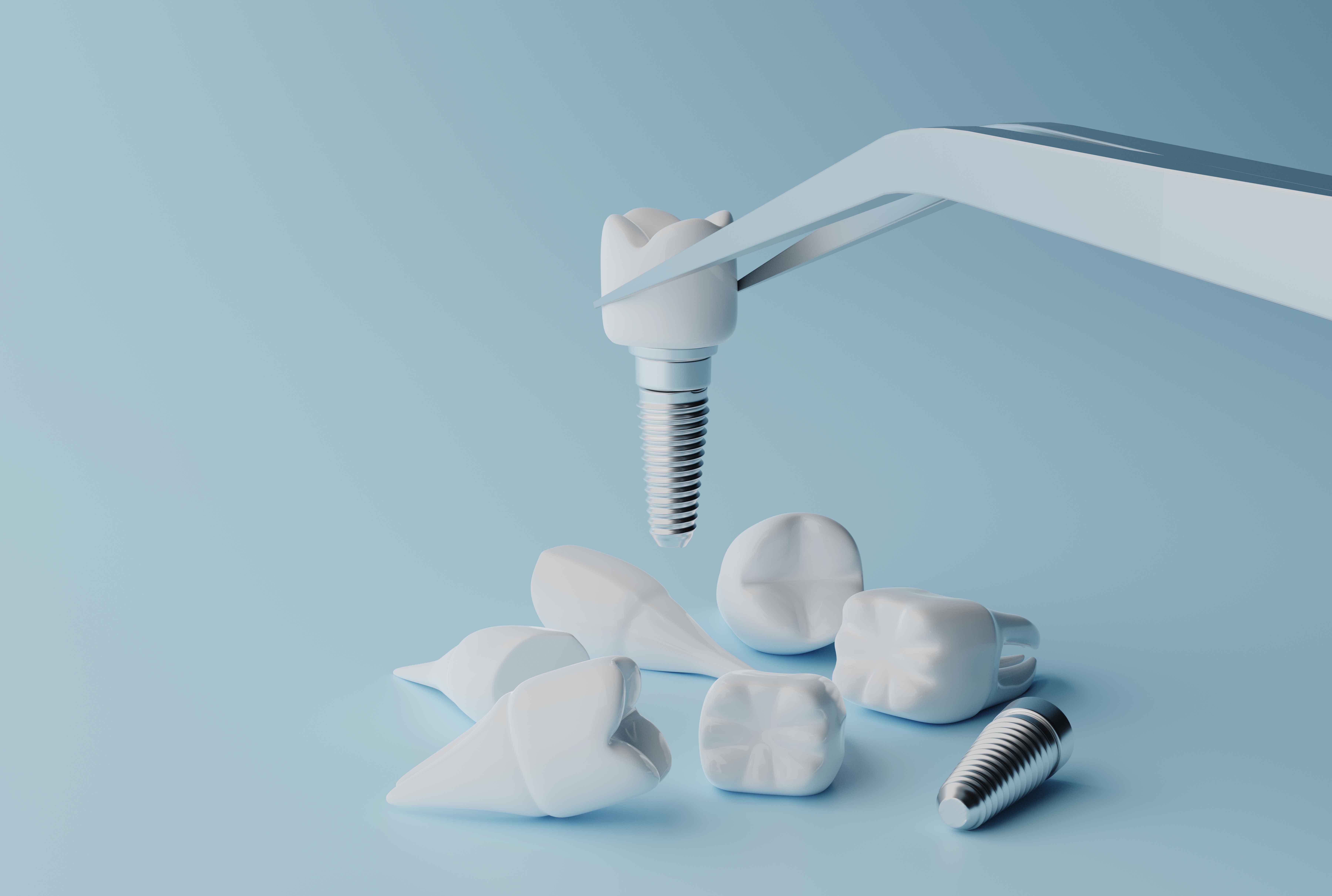 Best Family Clinic for Advanced Dental Implants Procedures in South Mumbai
