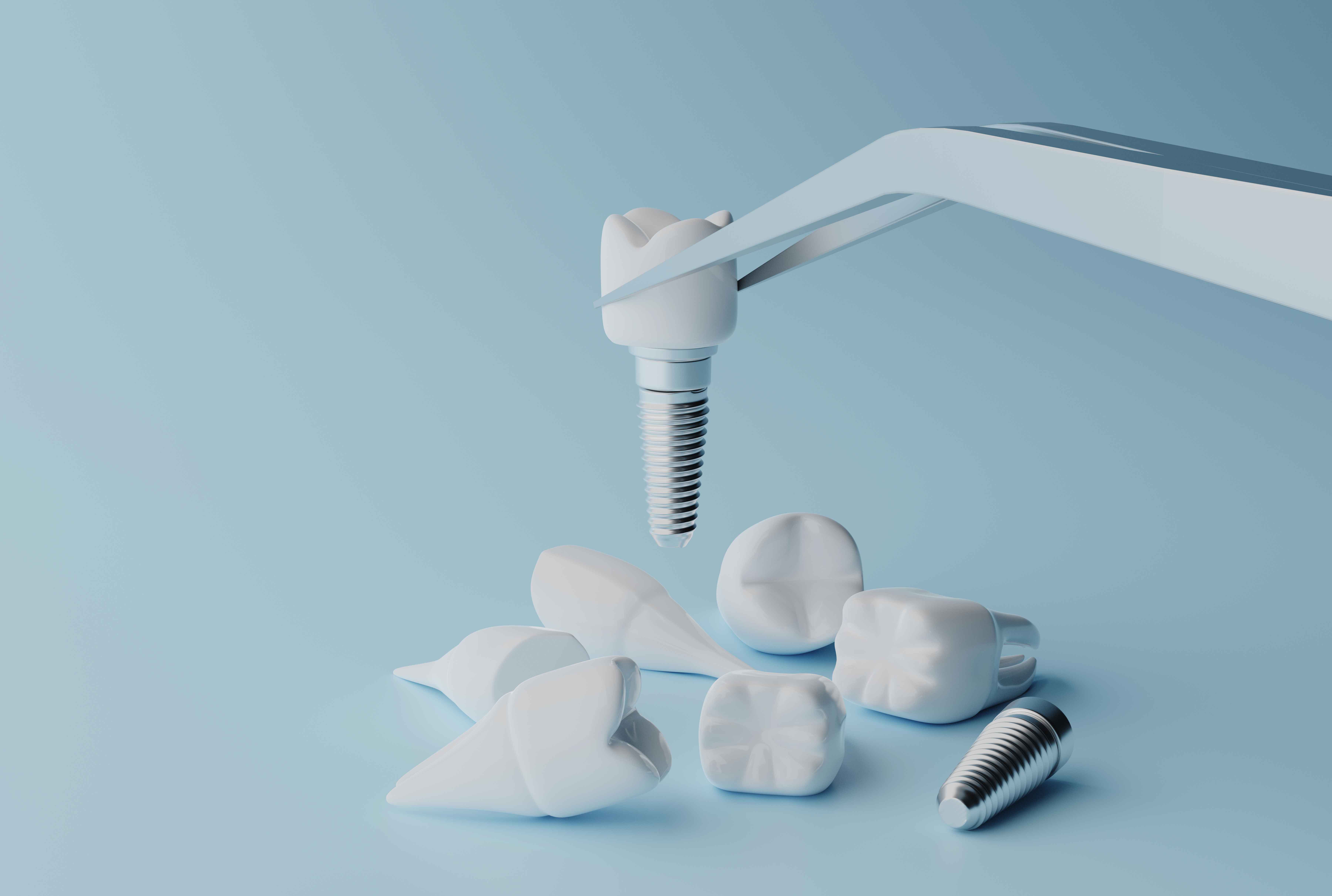 Best Family Clinic for Advanced Dental Implants Procedures in South Mumbai
