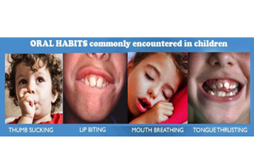 Oral habit commonly encountered in children