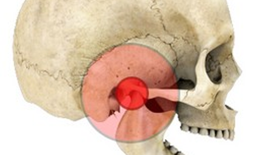 Skeleton explaining Temporomandibular Joint Disorders